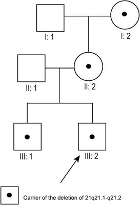 Prenatal Diagnosis and Genetic Analysis of 21q21.1–q21.2 Aberrations in Seven Chinese Pedigrees